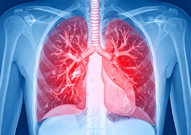 R&ouml;ntgenaufnahme eines menschlichen Brustkorbs mit hervorgehobenen roten Lungen und Bronchialverzweigungen.